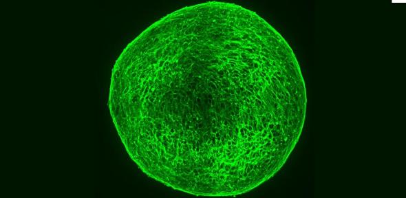 A ball of neuroblastoma cells forming mature nerves after drug treatment