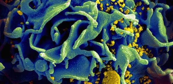 HIV-infected T cell