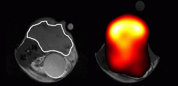 An abdominal tumour (outlined in white) 'feeding on' carbon-13-labelled glucose (orange) provides a means of testing when cancer drugs are effective enough to affect the health of the tumour