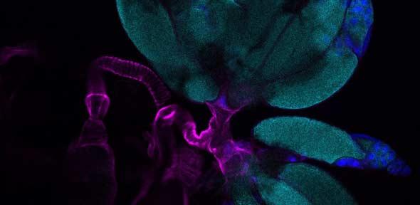 The reproductive machinery of Drosophila melanogaster. Two ovaries (upper right) connected by the oviduct.