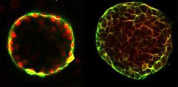 ‘Mini-bile ducts’ at day 25, stained with fluorescent dyes