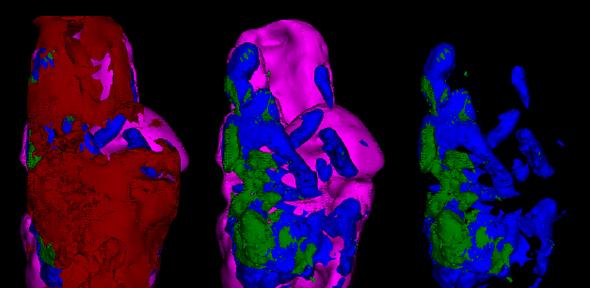 Imaging atherosclerotic calcification or ‘hardening of the arteries’ using positron emission tomography