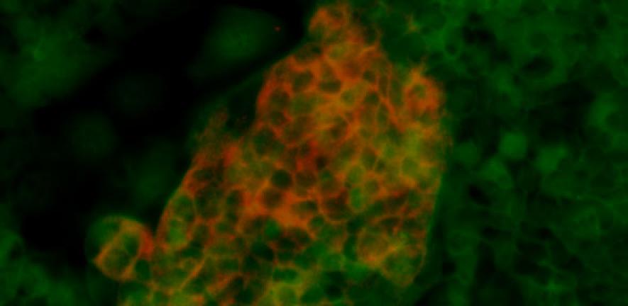 Foregut stem cells (green) differentiated into pancreatic cells expressing insulin. 