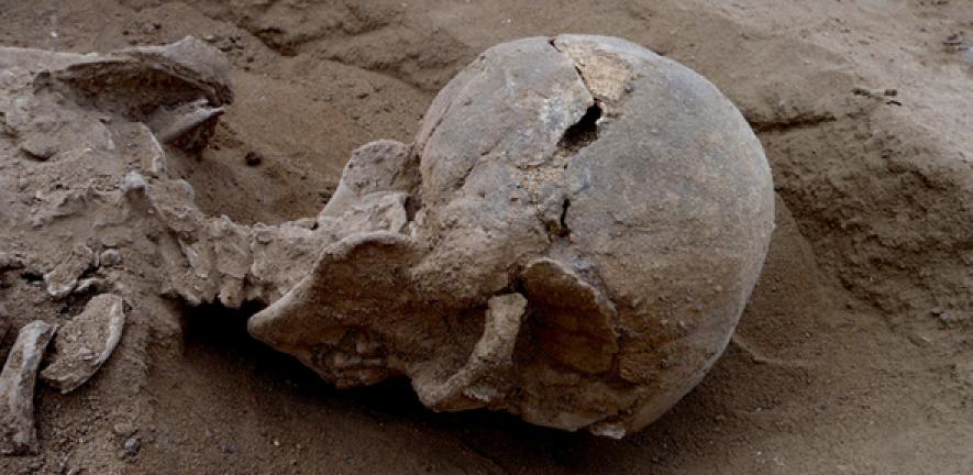 Skull of a man with multiple lesions on the side, probably caused by a club.