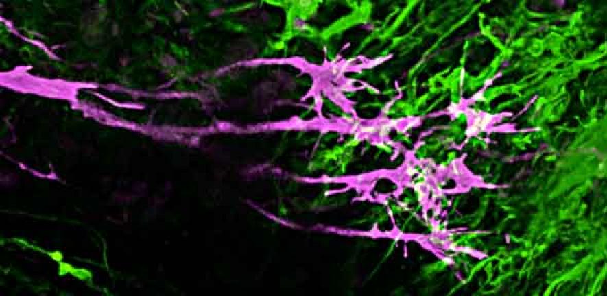 Growth cones of retinal axons (purple) growing among cells in the brain (green)