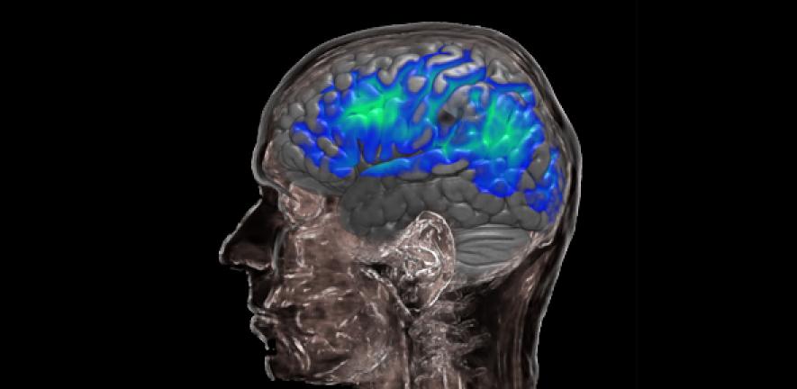 Brain areas with rich blood supply lower their vascular reactivity with ageing