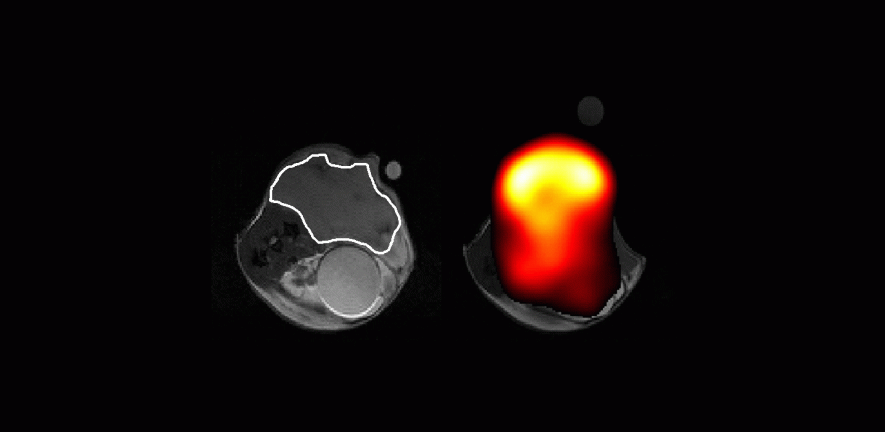 An abdominal tumour (outlined in white) 'feeding on' carbon-13-labelled glucose (orange) provides a means of testing when cancer drugs are effective enough to affect the health of the tumour