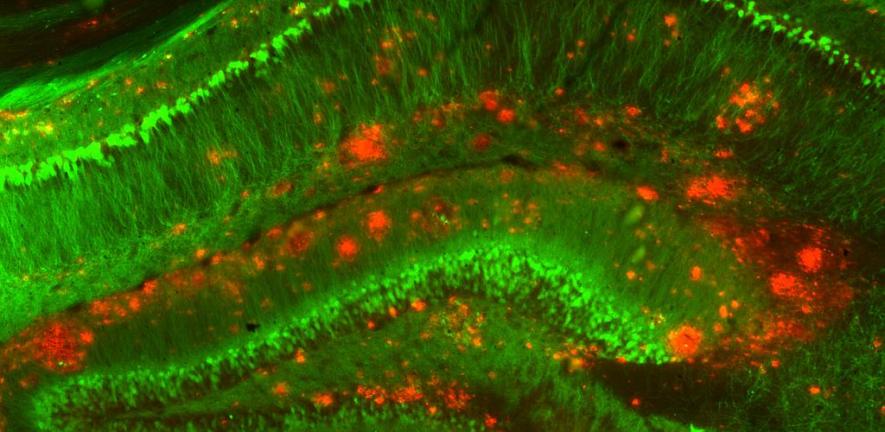 Mouse model of Alzheimer's disease