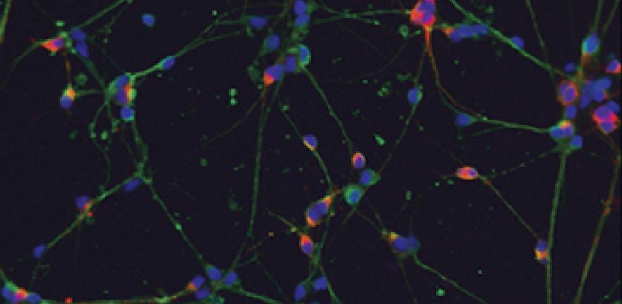 Dopaminergic neurons