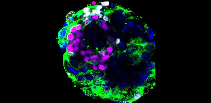 Human embryo cultured in vitro