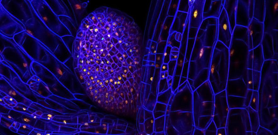 Ratiometric measurement of gene expression