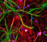 Brain cells obtained in tissue culture from human embryonic stem cells