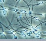 Sperm cells