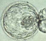 A human embryo at the blastocyst stage, about six days after fertilization, viewed under a light microscope.