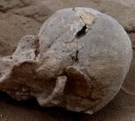 Skull of a man with multiple lesions on the side, probably caused by a club.