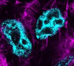 Actin cables in Drosophila nurse cells during late-oogenesis. At this stage, nurse cells die and extrude their cytoplasm into the developing oocyte.