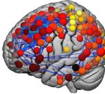 The brain’s structural network. The hubs of this network continue to develop during adolescence.