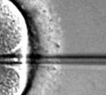 ICSI sperm injection into oocyte