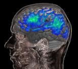 Brain areas with rich blood supply lower their vascular reactivity with ageing