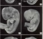 Photos of embryos of horizon XVII, published in Contributions to Embryology in 1948 and still in use as Carnegie Stage 17. 