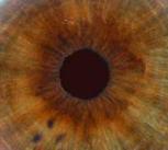 Iris (eye)