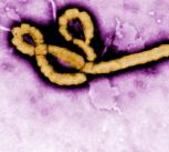 Ebola virus