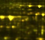 Gel electrophoresis