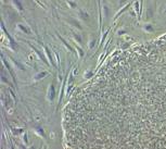 iPS cell colony