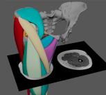 A cross-section of the polygonal muscle modelling approach, guided by muscle scarring and MRI data. 