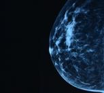 Mammogram image