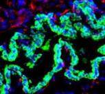 mage of a mouse gallbladder following repair with a bioengineered patch of tissue incorporating human 'bile duct' cells, shown in green. The human bile duct cells have fully repaired and replaced the damaged mouse epithelium