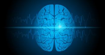 Visual representation of focal epilepsy