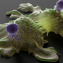 Illustration of T cells attacking cancer cells