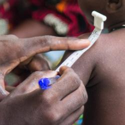 Check-up at MRC Unit The Gambia