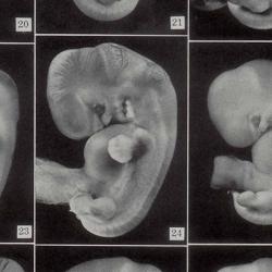 Photos of embryos of horizon XVII, published in Contributions to Embryology in 1948 and still in use as Carnegie Stage 17. 