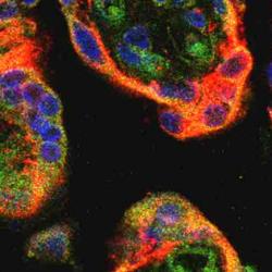 Human placental villi showing signs of oxidative stress