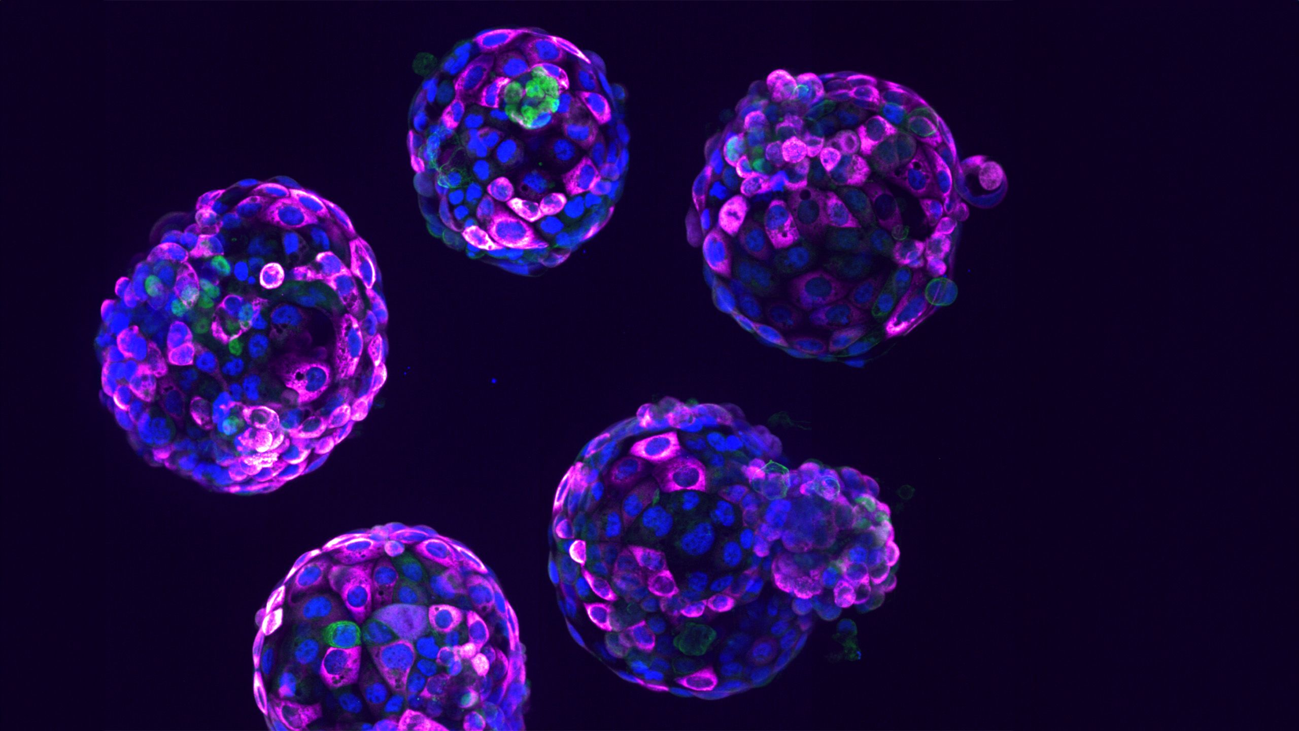 Stem cell based embryo model