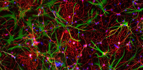 Brain cells obtained in tissue culture from human embryonic stem cells