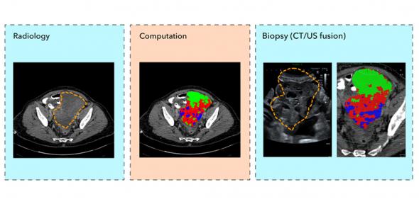 Image showing individual and combined scans