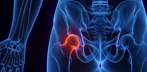 Illustration of a human hip joint