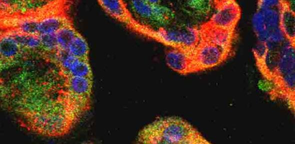 Human placental villi showing signs of oxidative stress