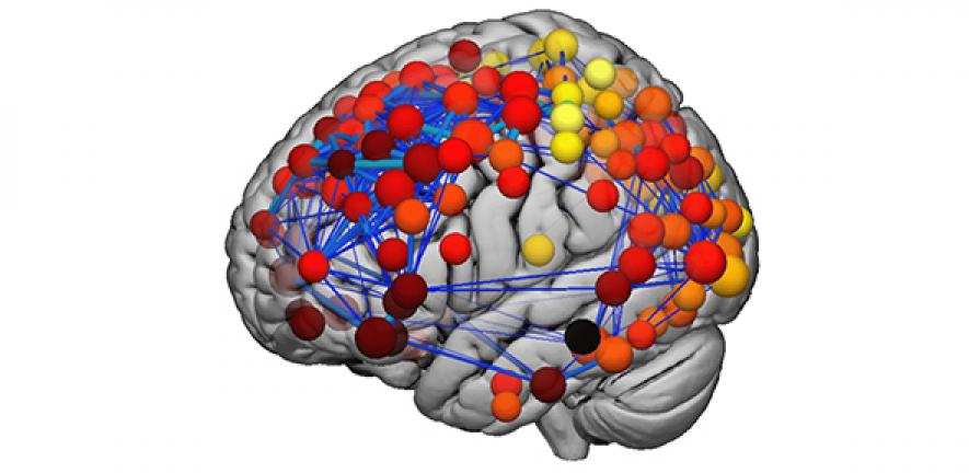 Opinion How Mapping Teenagers Brains Has Helped Us Understand More About Schizophrenia University Of Cambridge