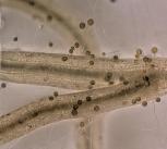 Plant roots interacting with arbuscular mycorrhizal fungi. Image: Luginbuehl lab