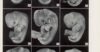 Photos of embryos of horizon XVII, published in Contributions to Embryology in 1948 and still in use as Carnegie Stage 17. 