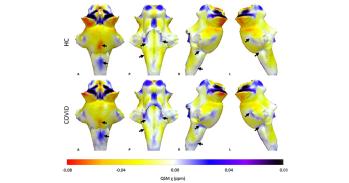 3D projections of QSM maps on the rendered brainstem