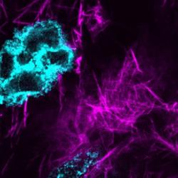 Actin cables in Drosophila nurse cells during late-oogenesis. At this stage, nurse cells die and extrude their cytoplasm into the developing oocyte.
