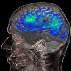 Brain areas with rich blood supply lower their vascular reactivity with ageing