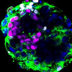 Human embryo cultured in vitro