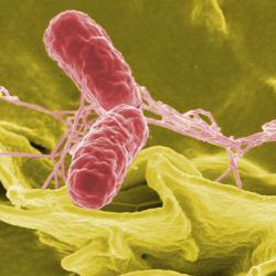 Color-enhanced scanning electron micrograph showing Salmonella Typhimurium (red) invading cultured human cells