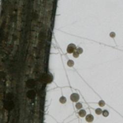 This microscopic image shows the spores and hyphae of 'friendly' arbuscular mycorrhizal fungus interacting with a plant root.